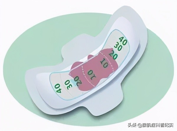 子宫腺肌症会导致小腹坠胀吗,子宫腺肌症肛门坠胀如何缓解