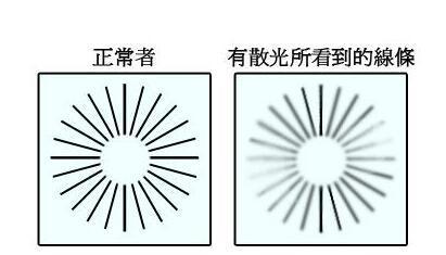 散光是什么意思和远视怎么区分,近视散光与散光的区别