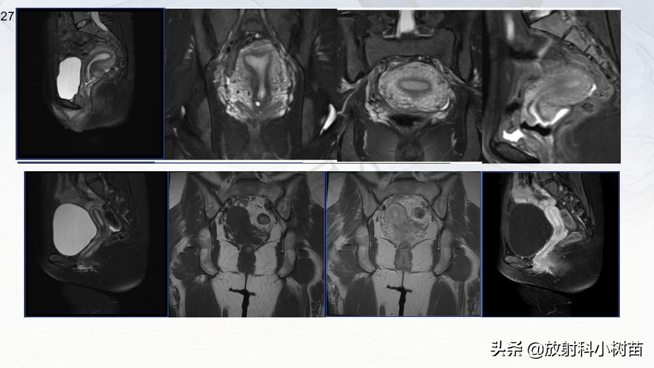 女性盆腔mri解剖图谱,泌尿生殖系统x线解剖