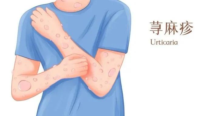 阿嚏~不好意思，我对这个过敏