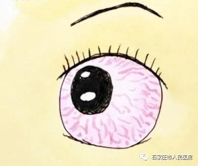 市人民医院专家提示您：“飞蚊症”可能是眼底疾病