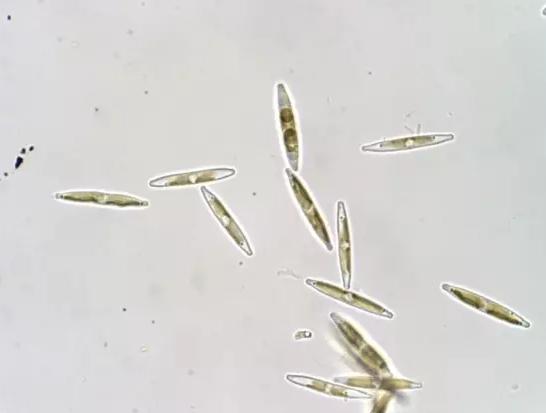 硅藻水,硅藻水和绿藻水区别