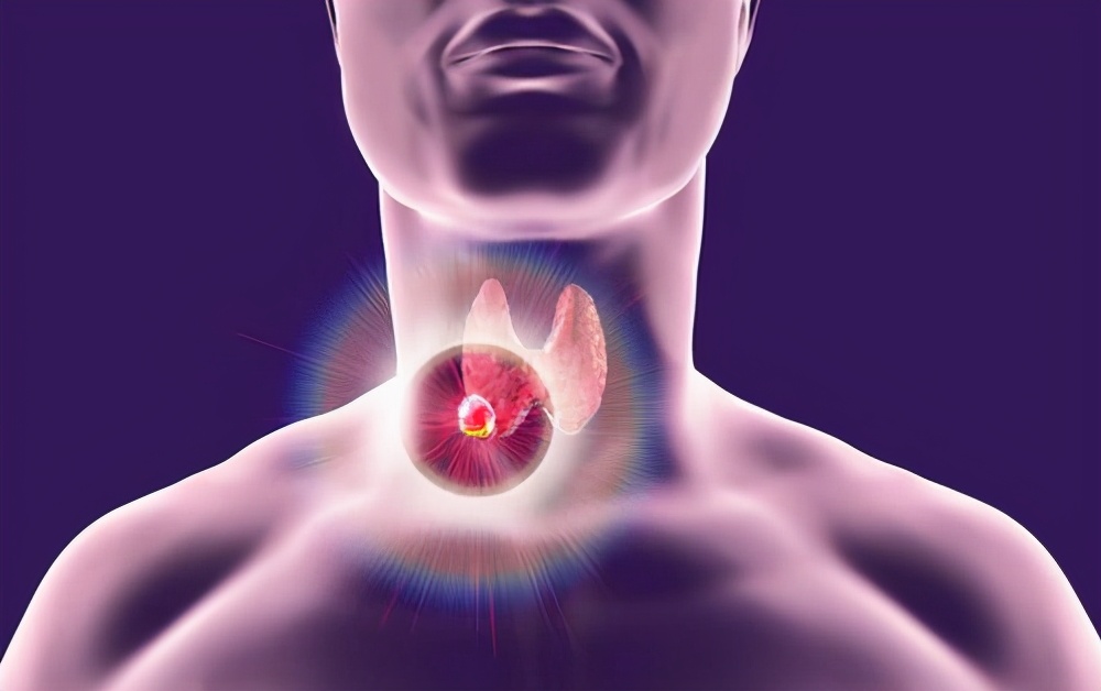 为什么有些人备受结节“偏宠”？结节到底是什么？