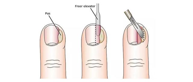 手黄涂什么指甲油好看,怎么涂指甲油漂亮又好看