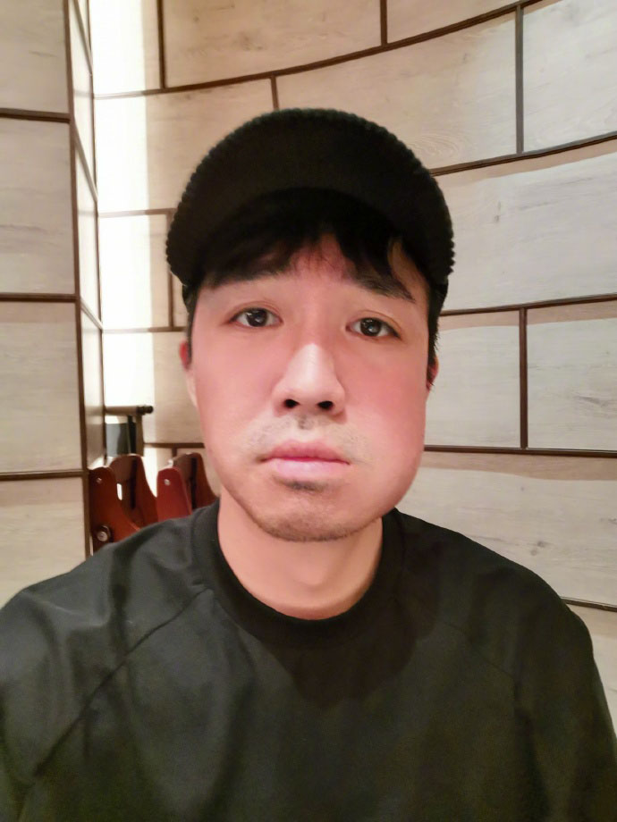 俞灏明的脸能修复吗,俞灏明的脸怎么修复的