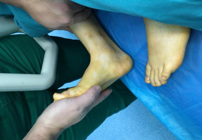 在深莞交界的光明，这位“伯伯”让早产宝宝的救治成功...