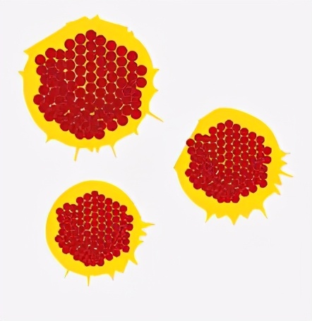 得了生殖器疱疹真的那么可怕吗,生殖器疱疹真那么可怕吗