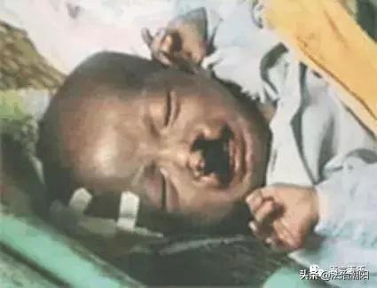 毒品婴儿,毒婴儿