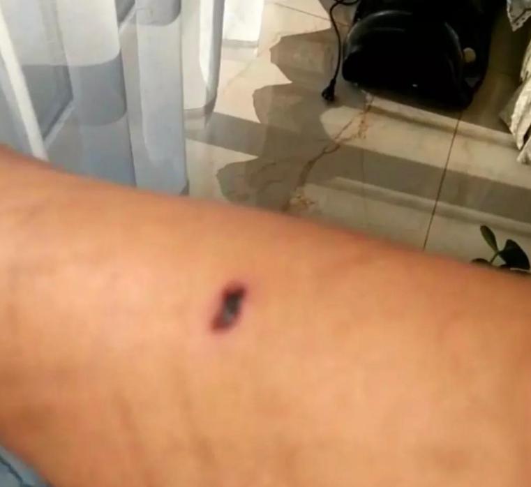 社会狗打架事件,社会狗打架