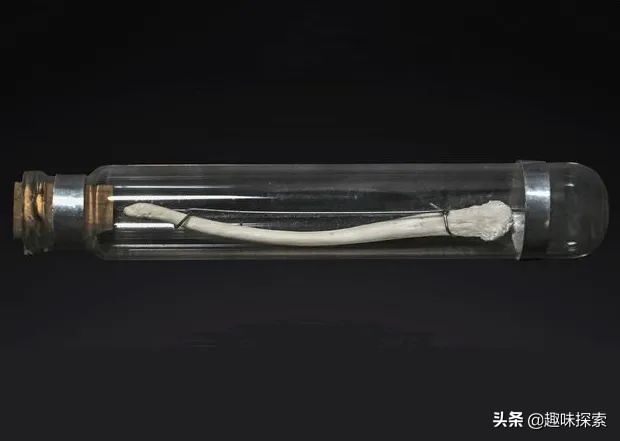 人类*亲近**存在阴茎骨，为何人类却褪去了，祖先经历了什么？