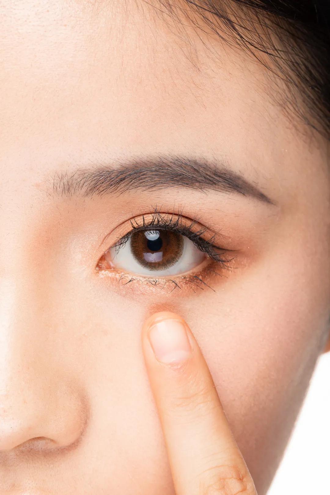 护肤消除泪沟纹,护肤去除皱纹大眼袋