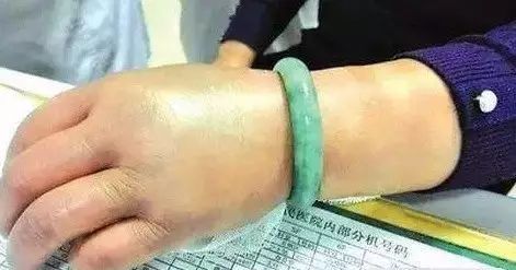 手镯戴了可以随意取吗,手镯戴手上取不下来怎么鉴定真假