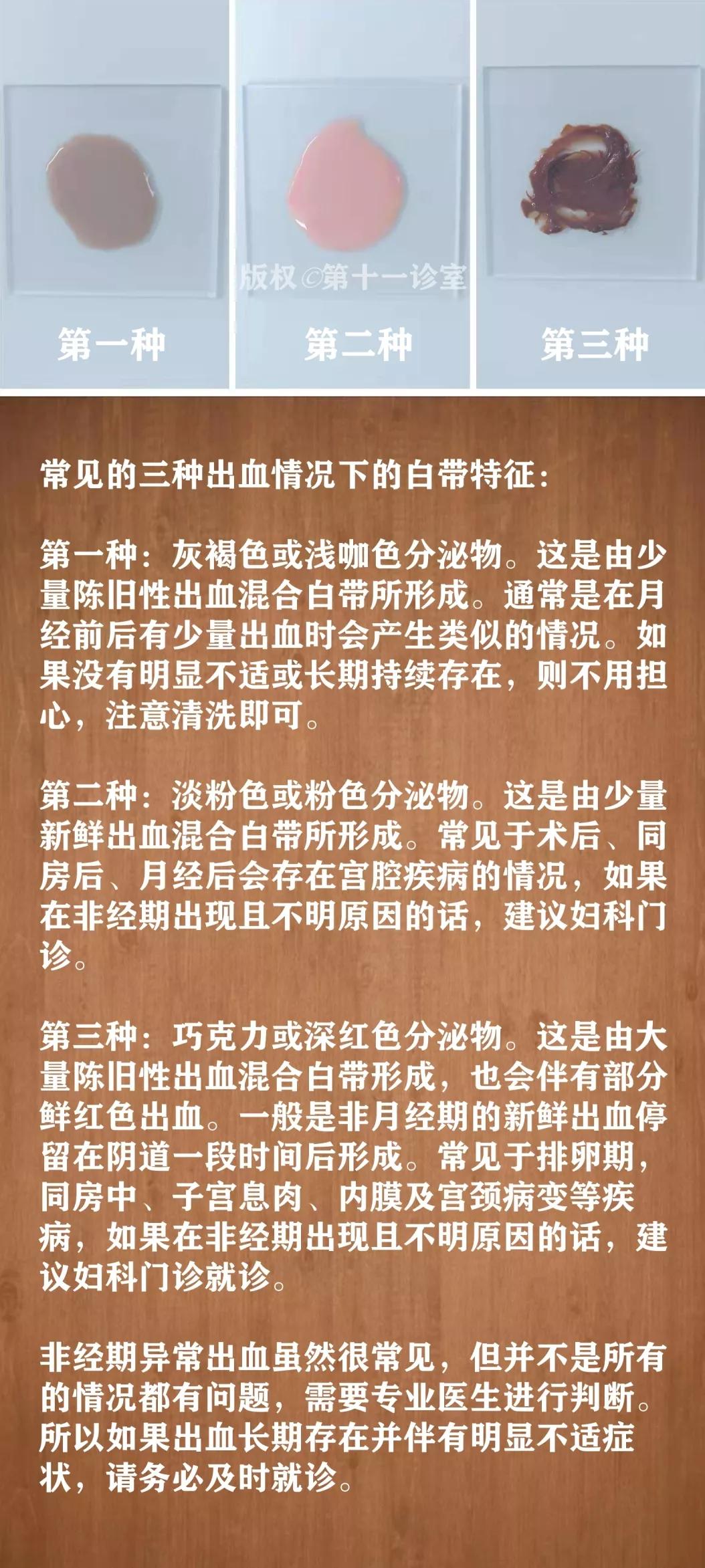 女人妇科白带的知识,女生白带冷知识