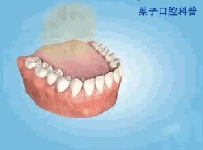 葉子口腔科普,口腔健康自查