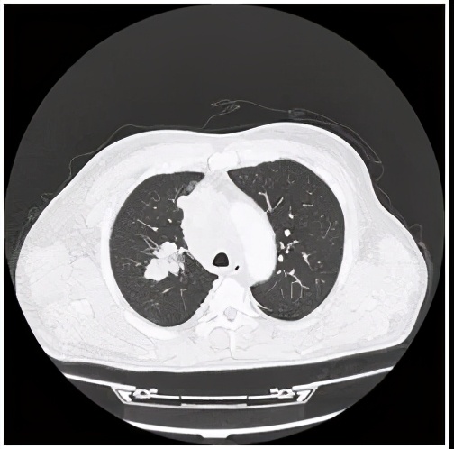 奇迹再现治愈版,医学奇迹再现视频