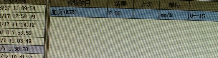 中西医结合治疗原因不明肠梗阻、腹水转氨酶明显升高病案一例！