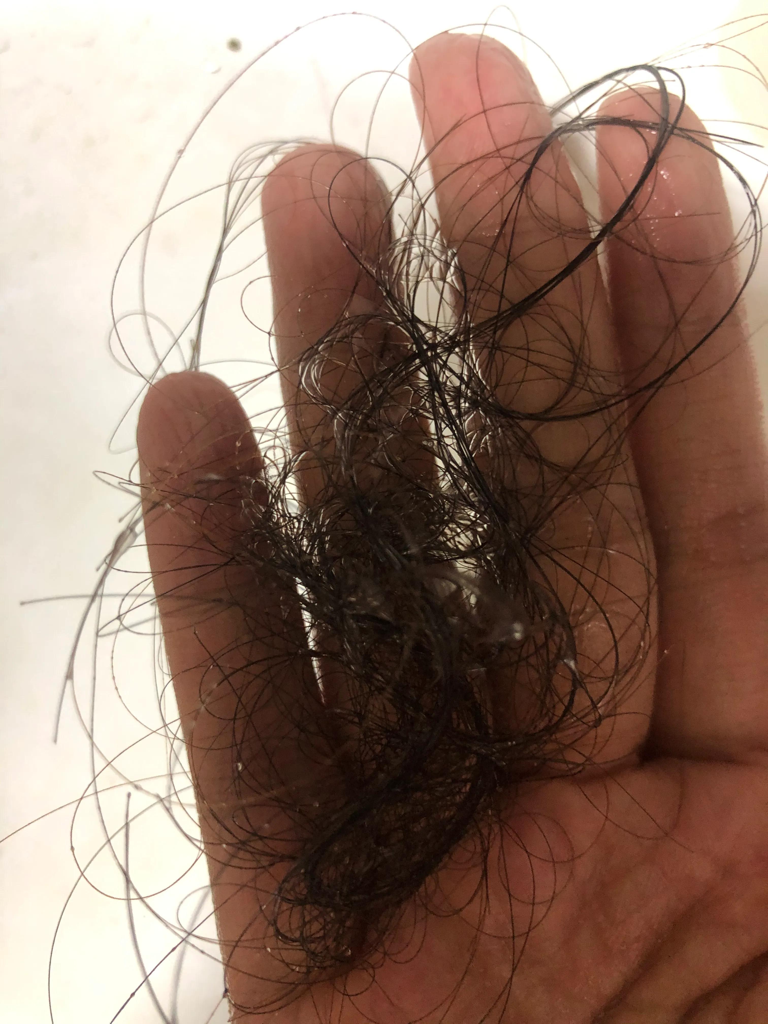 产后掉发吃什么食物好,产后第二年掉发严重