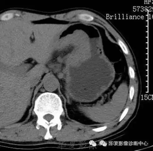 这些部位的黑色素瘤，您会诊断吗？
