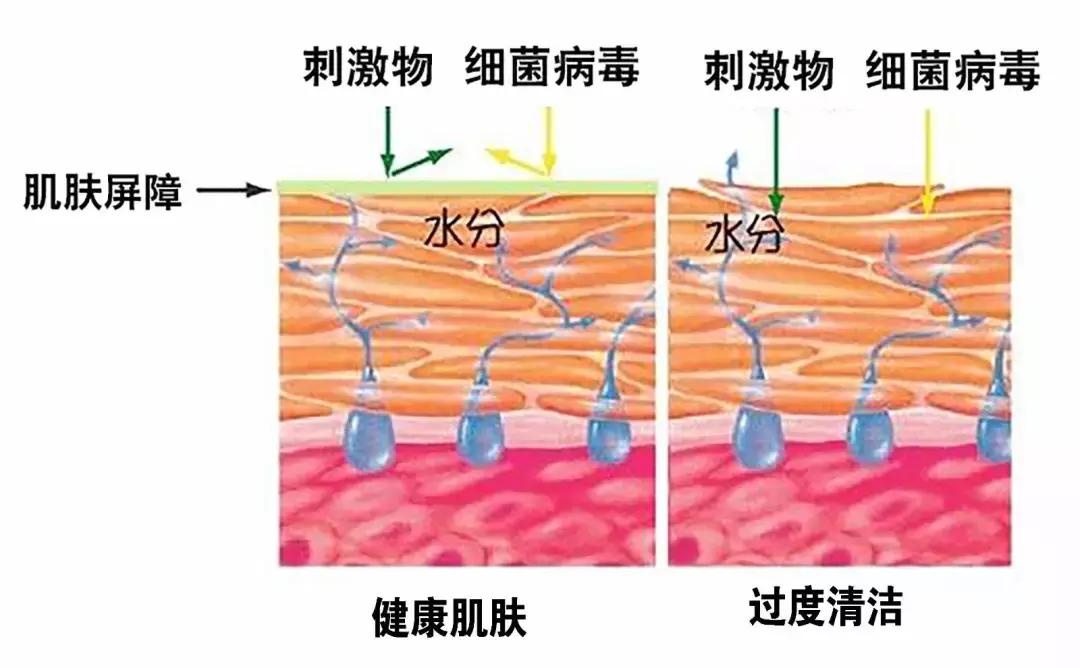 角质层薄容易过敏,角质层薄适合的水