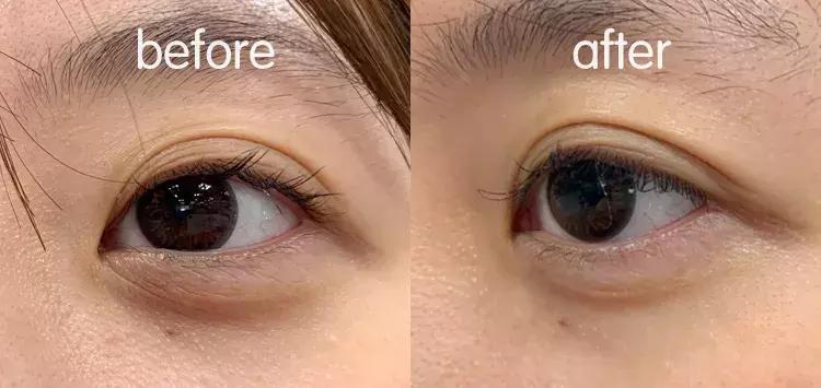 有了前法国第一夫人的百元“黑科技”眼霜，我把3000块眼霜扔了！