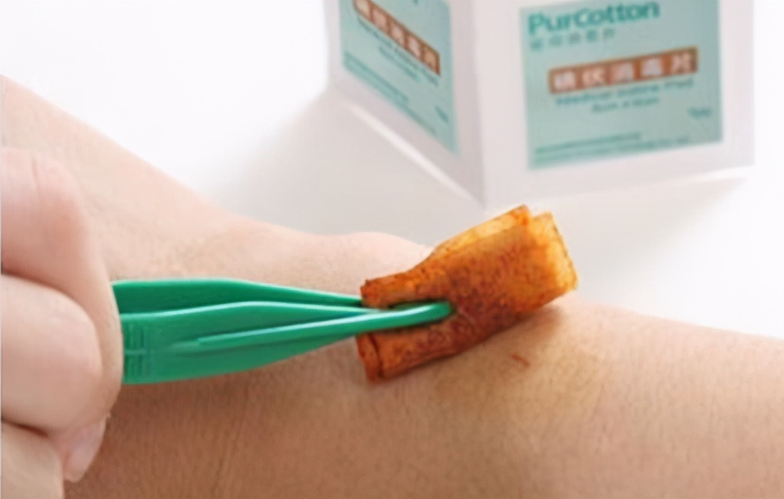 碘伏弄到衣服上用洗衣粉能洗掉吗,碘伏弄到衣服上能洗掉吗