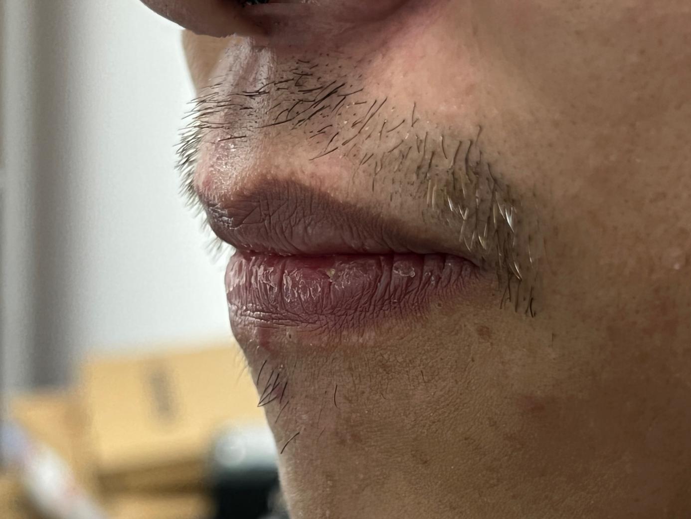 飞科剃须刀fs926好还是fs927好,电动剃须刀男士刮胡子正品飞科