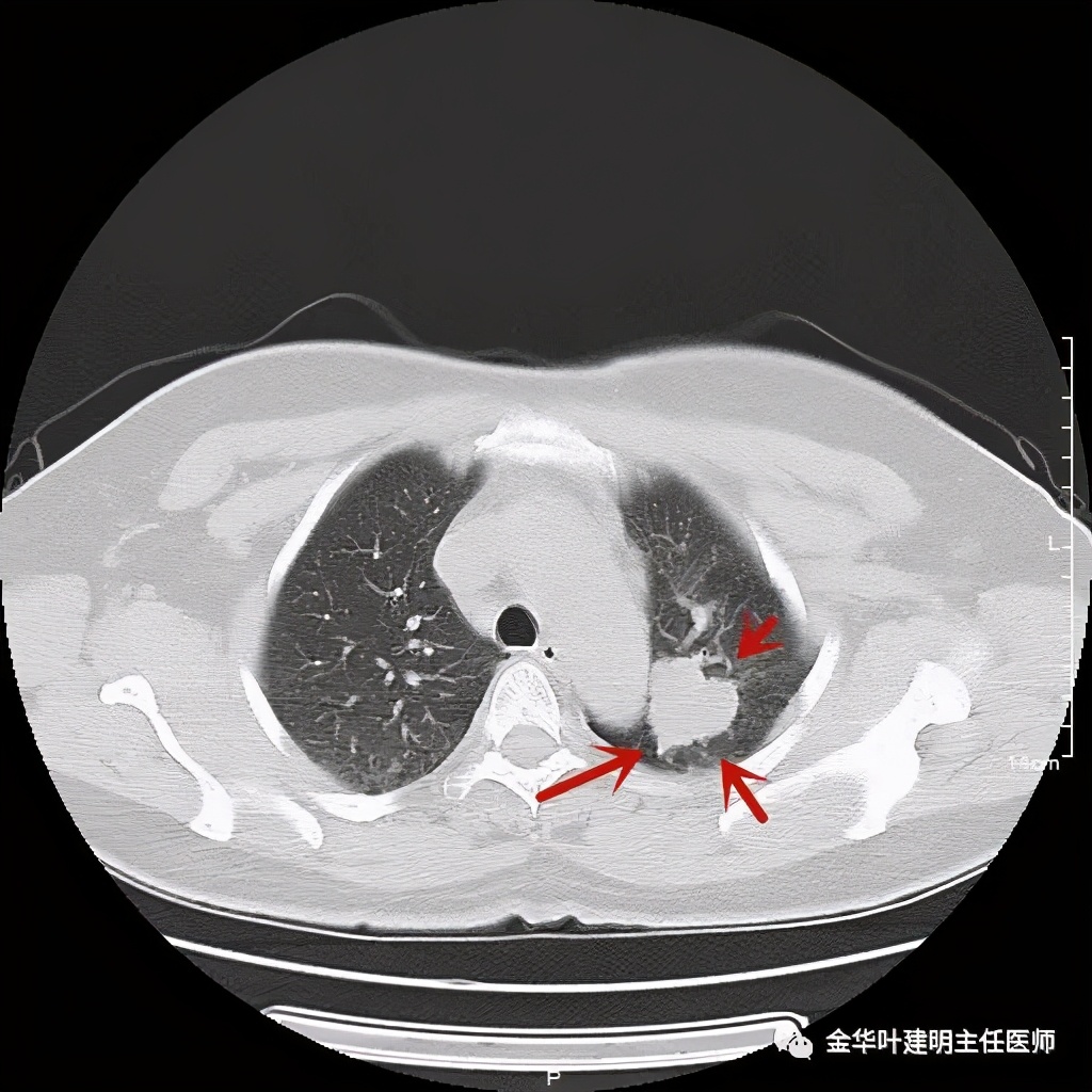 放个大招完整版教学,放个大招完整版前奏