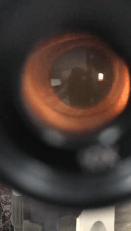 为什么眼睛里有黑点跑来跑去,眼睛前面总有黑点在飘是什么原因