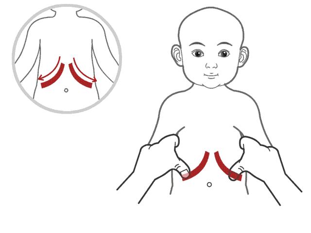 新生儿肠胀气最好的解决方法,新生儿肠胀气有什么解决方法