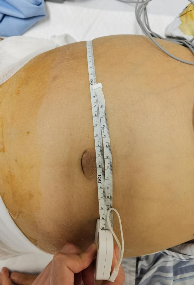 有东西进入肚子里肚子突然变大,肚子突然鼓鼓的像怀孕一样