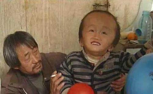 毒奶粉大头娃娃现状,毒奶粉大头娃娃现在怎么样