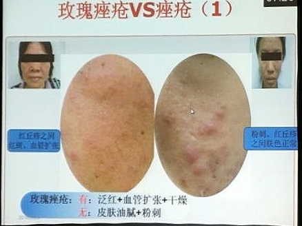 皮肤科医生经典小故事,皮肤科病例故事