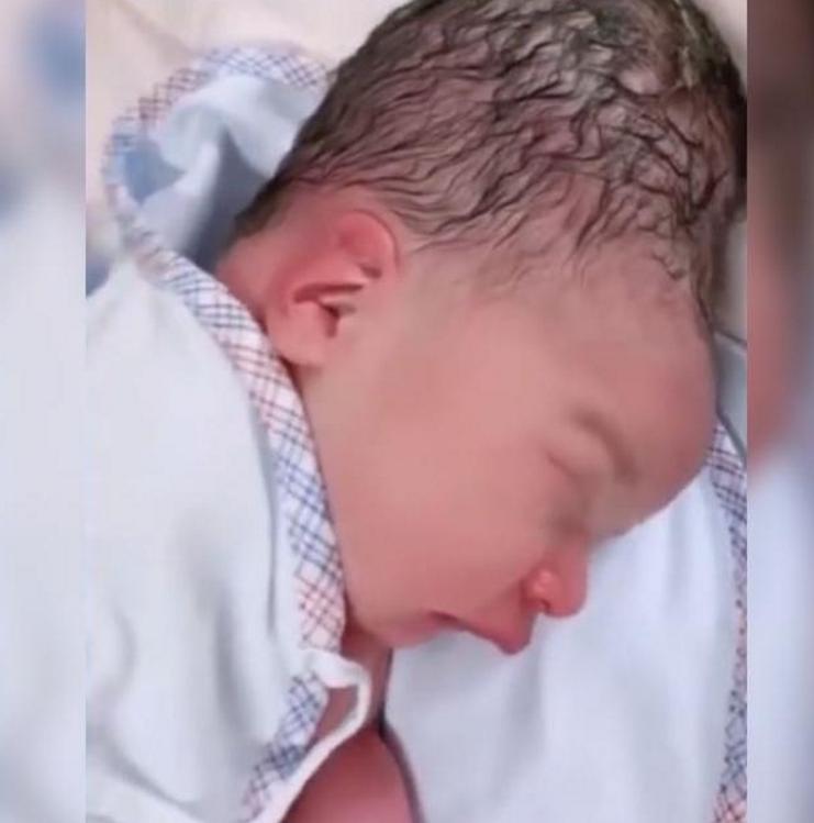 分娩时婴儿头部挤压怎样恢复,分娩时宝宝脑袋被挤压变形