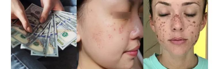 如何避免频繁戴口罩引起皮肤问题,戴口罩后护肤注意什么