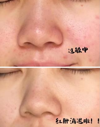 推荐几款实用的洗面奶,5款推荐的洗面奶