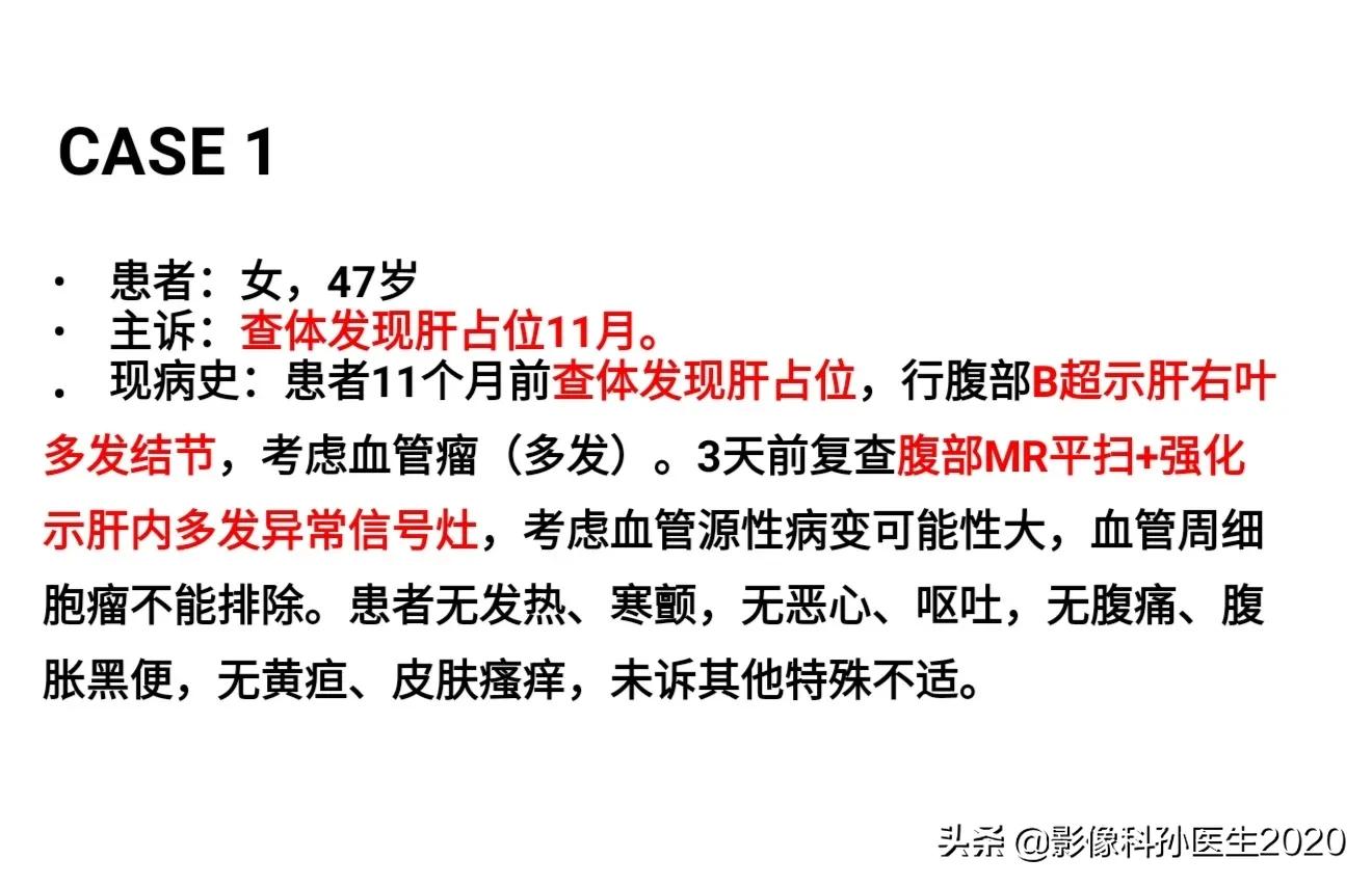 肝上皮样血管内皮瘤全国多少例,肝上皮样血管内皮瘤超声表现