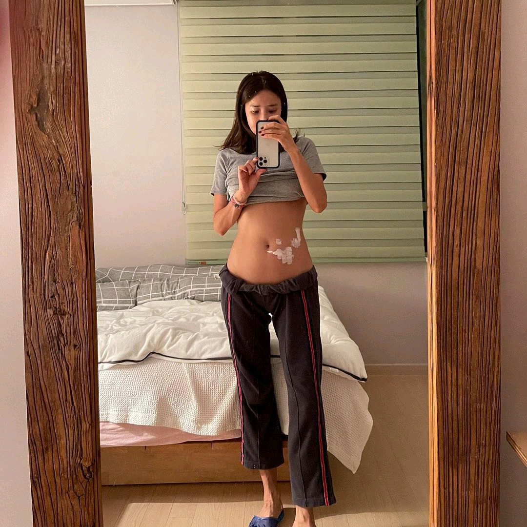 韩国女星肚子残留明显带状疱疹伤口，“失去感觉，必须治疗神经”