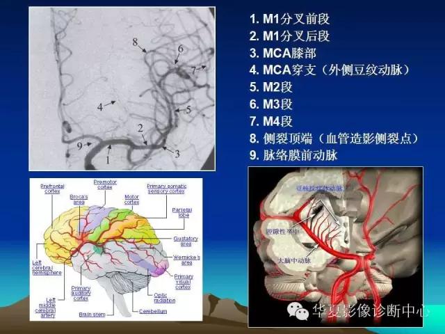 小脑血管解剖分段,脑血管影像解剖讲解