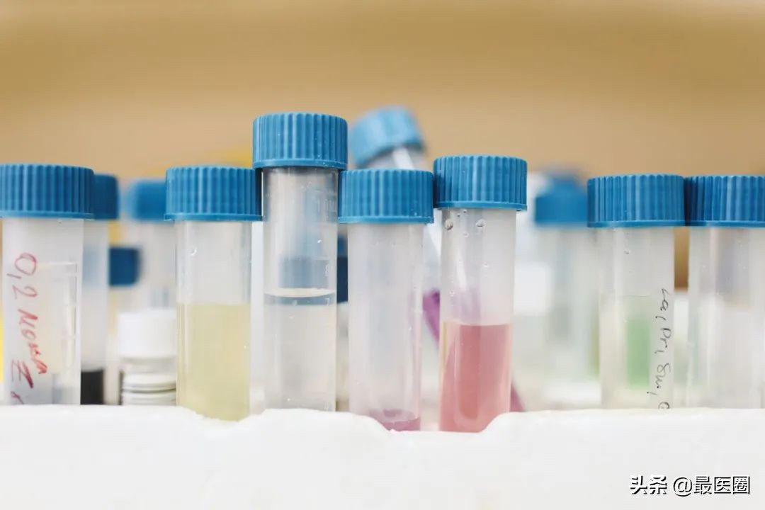 看似平平无奇的尿液，在向我们身体发出了什么警报？