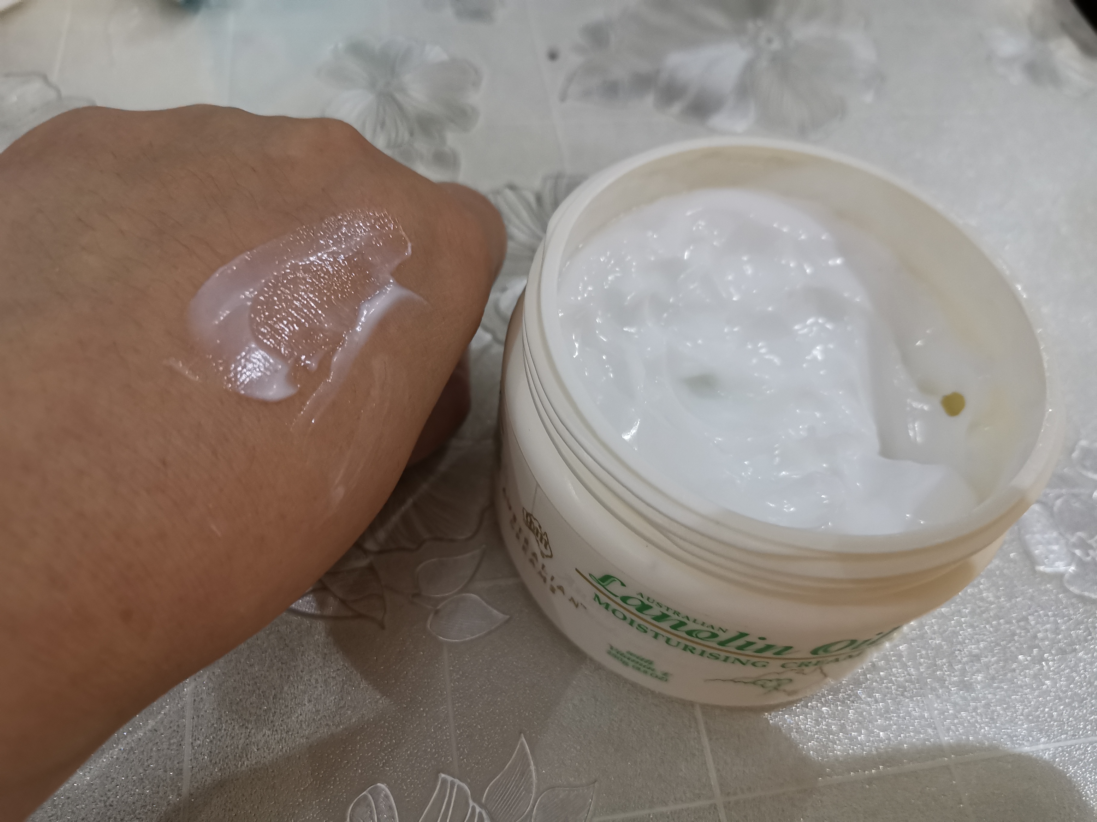 宝宝湿疹干燥用什么霜,babymilkycream面霜能治湿疹吗