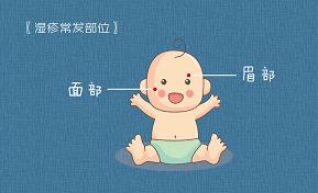 破皮结痂,又到湿疹高发季!这样护理更有效果