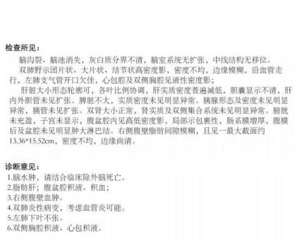 孕妇恶心呕吐，误以为是肠炎，却把性命丢了