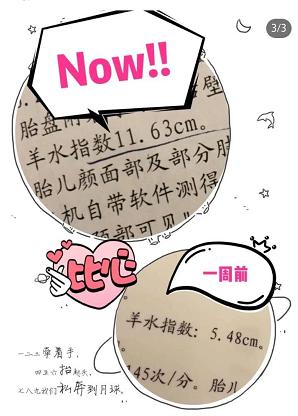 孕妇37周羊水少还需要补羊水吗,孕晚期羊水少喝椰汁可以补回来吗