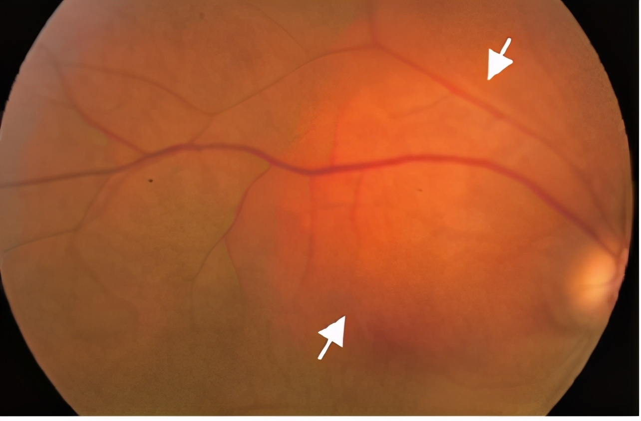 眼科医生和影像医生哪个好,真正的眼科医生