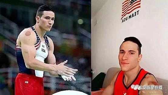 美国军队中的中医,美军应用中医针灸治病