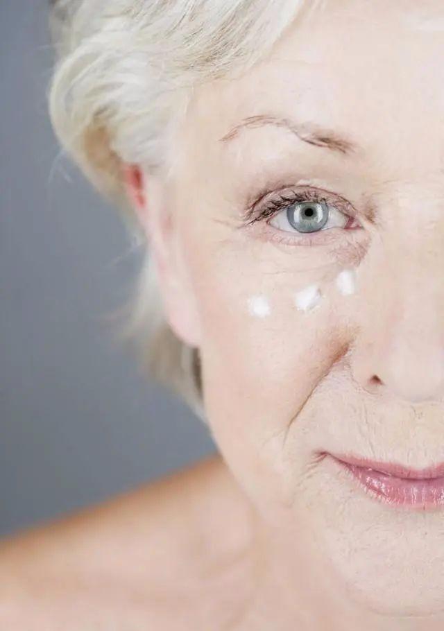 去鱼尾纹最简单的方法是哪种,名门泽佳怎么去黑眼圈