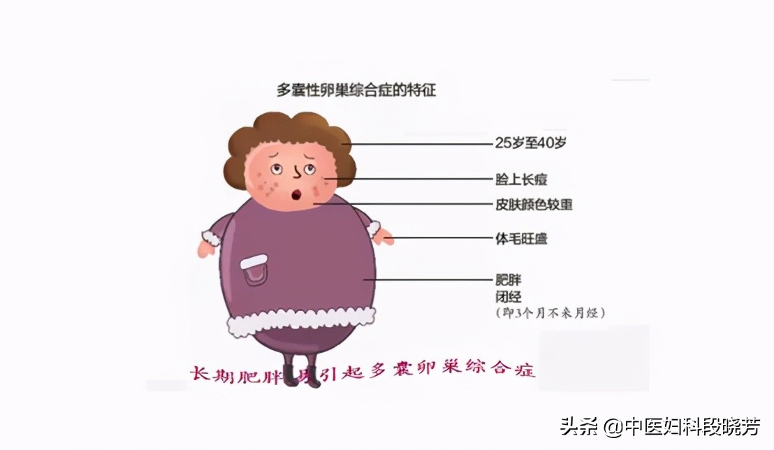 段晓芳治多囊的费用,妇科专家段晓芳