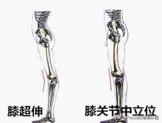 小腿粗外翻怎么穿短裙,穿高跟鞋导致腿粗怎么减