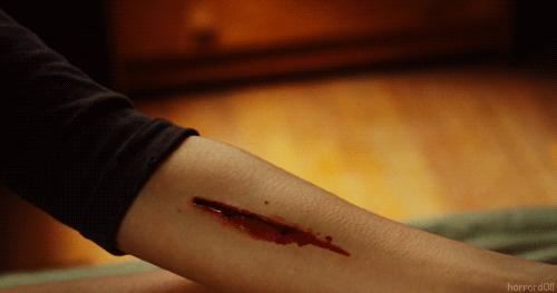 往伤口上撒盐撒辣椒粉,在伤口上撒盐有多疼