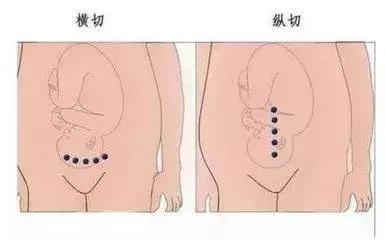 世上最丑的“微笑”……你不喜欢拥有它,但它的伟大无可否认!